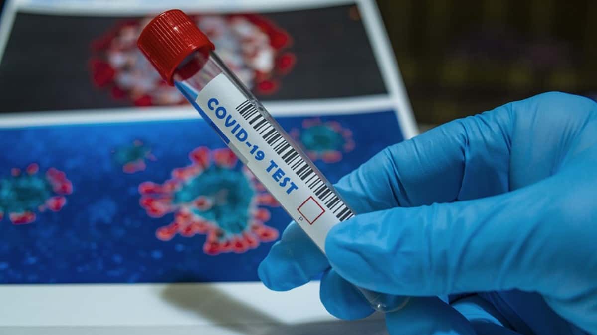 Colombia suma otros 9.173 contagios y 366 fallecidos por coronavirus