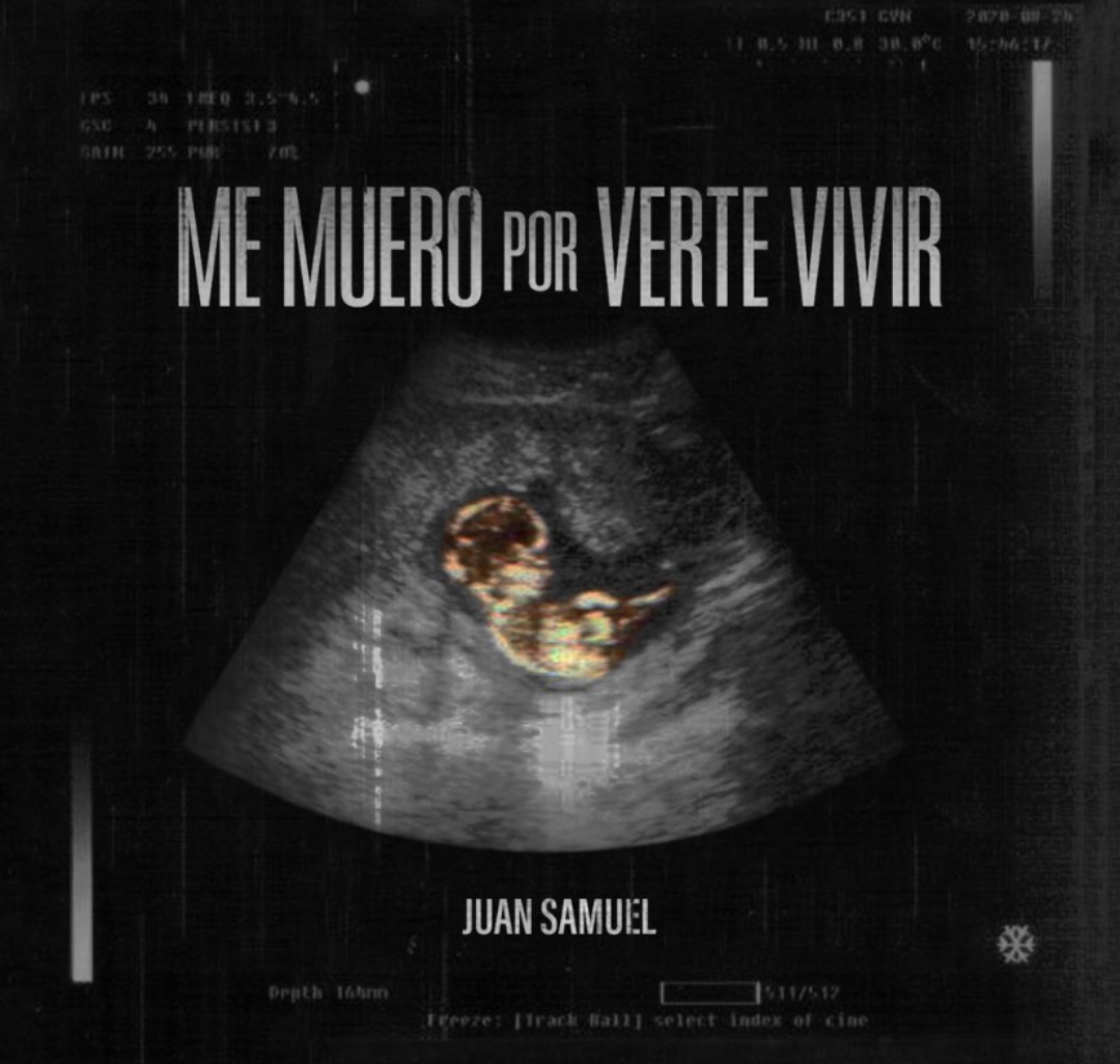 Juan Samuel: “Me muero por verte vivir” (+vídeo) | Diario 2001