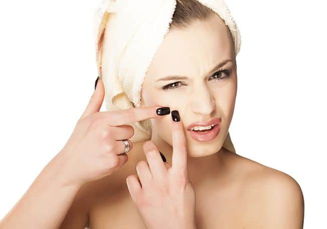 Aprende a extraer una espinilla sin dañar la piel | Diario 2001
