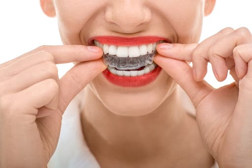 Férulas dentales: un tratamiento sencillo | Diario 2001