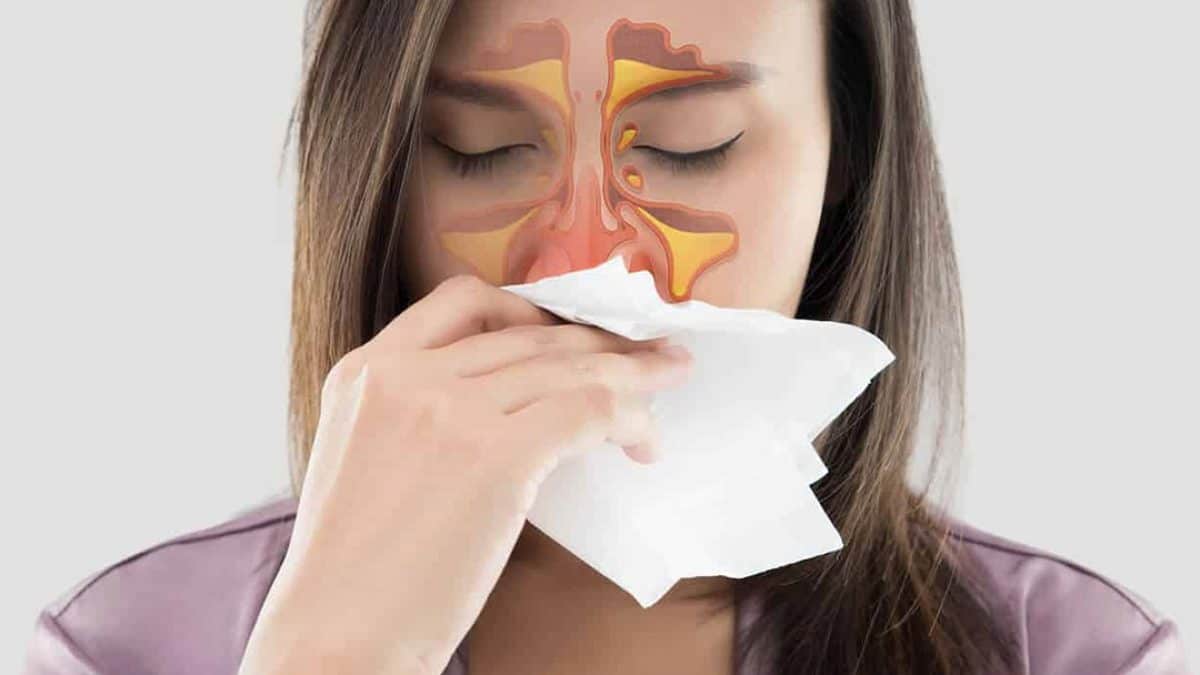 ¿Cómo combatir la sinusitis naturalmente? | Diario 2001