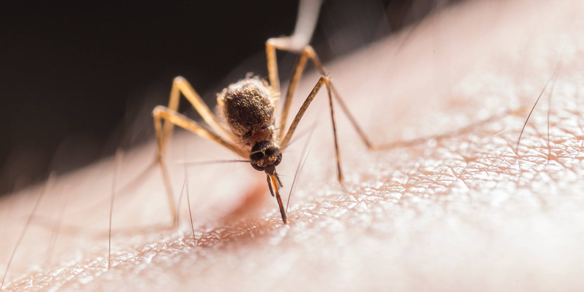 Síndrome de Skeeter: reacción alérgica a la picadura de mosquito | Diario 2001
