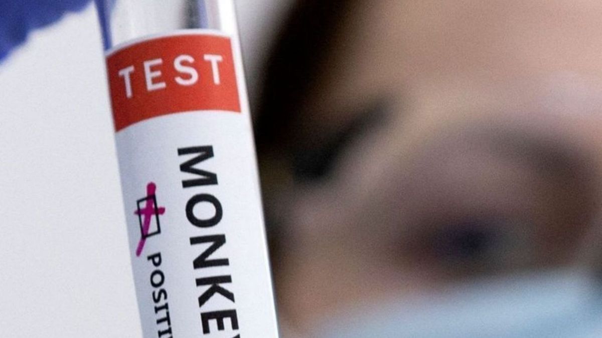 Academia de Medicina pide activar alertas para evitar viruela del mono