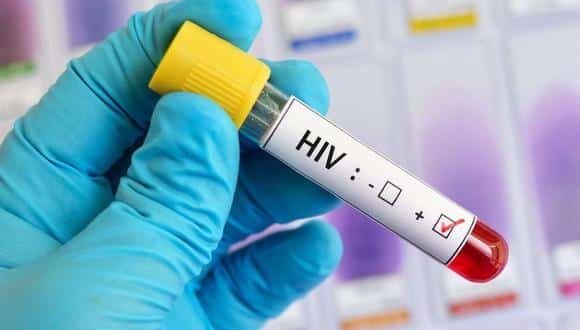 Cancelan estudio de vacuna contra el VIH en la última etapa