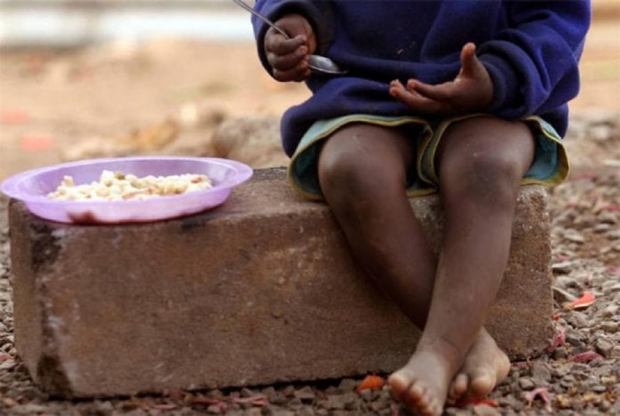 ¡Desnutrición en Colombia! Al menos 308 menores fallecieron durante el año 2022 | Diario 2001