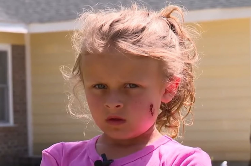 EEUU: Niña de seis años, baleada en la cara, pidió esto para su agresor