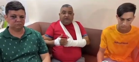 Alcalde oficialista fue agredido a batazos en el Zulia