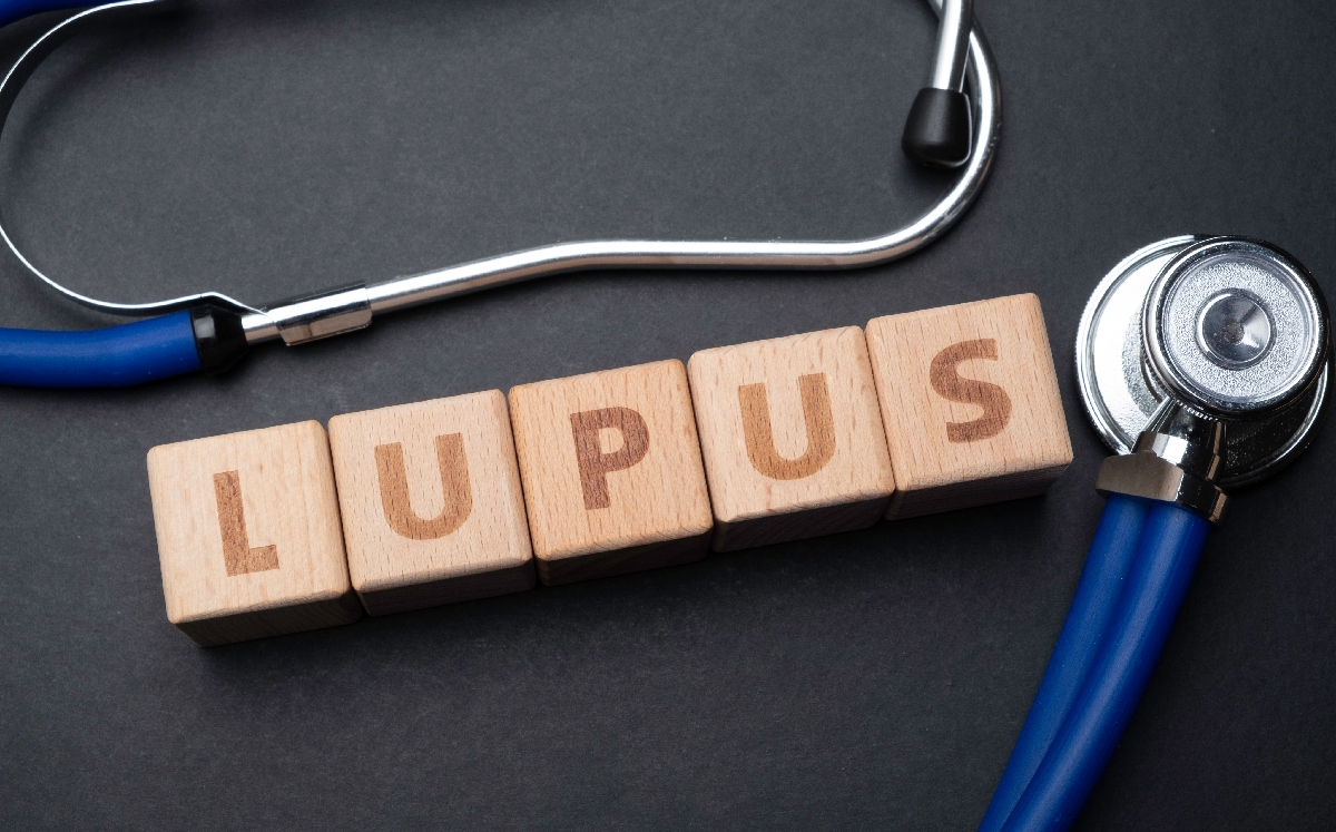 ¿Qué es y cuáles son los síntomas del lupus? | Diario 2001