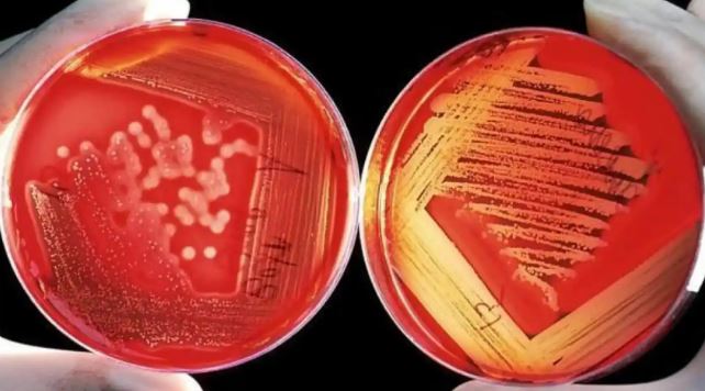 Alarma en Europa por la propagación de una bacteria resistente a los medicamentos