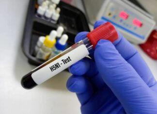 EEUU | Detectan gripe aviar “altamente patógena” en humano