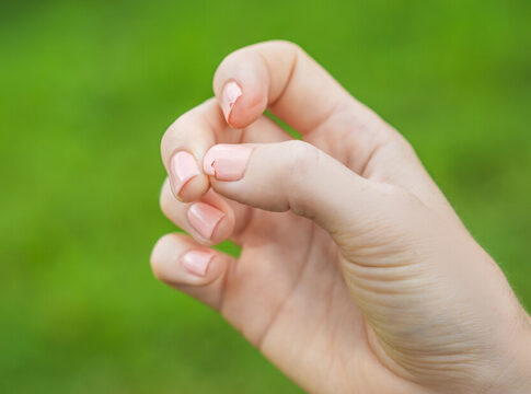 Lo que debes evitar para no tener uñas quebradizas