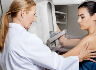 EEUU | Consulte aquí donde hacerse una mamografía a bajo costo en Houston