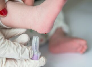 Realizan pruebas del talón gratuitas a recién nacidos en Petare (+Fecha)
