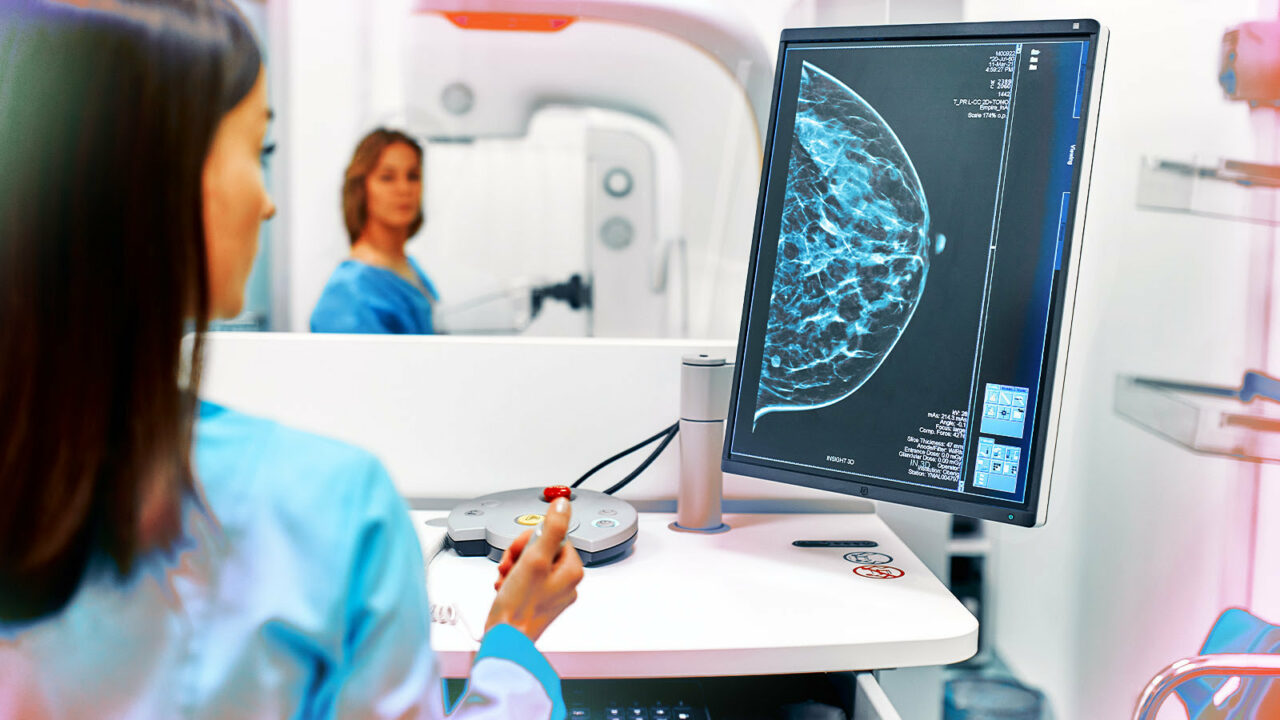 Texas | Realizan nueva jornada de mamografías gratuitas en Dallas (+Fechas)