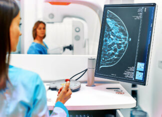 Texas | Realizan nueva jornada de mamografías gratuitas en Dallas (+Fechas)